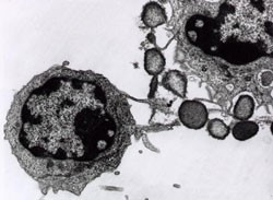 Proiectul CAR-NK se desfășoară în Centrul de terapii genice și celulare în tratamentul cancerului OncoGen - Spitalului Clinic Județean de Urgență Timișoara